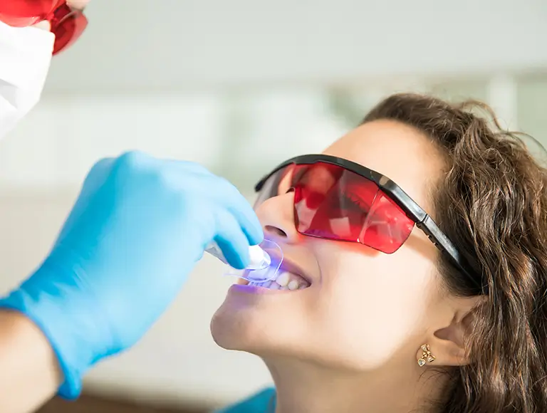 Professional teeth whitening